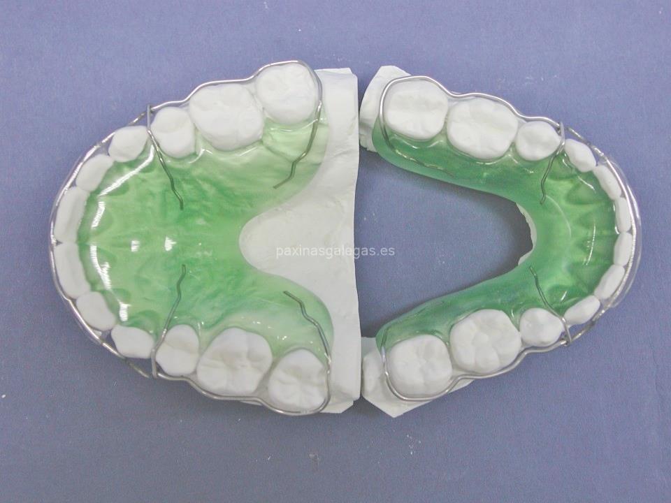 Biarc - Laboratorio de Ortodoncia imagen 19