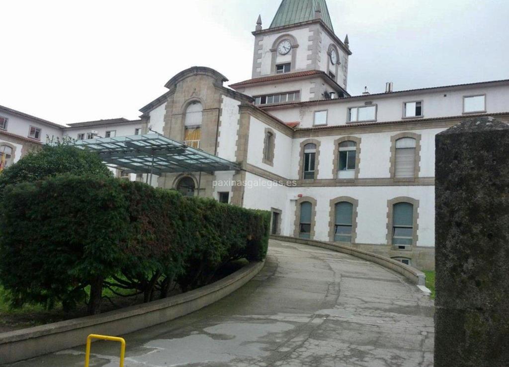 imagen principal CHOP - Complexo Hospitalario de Pontevedra