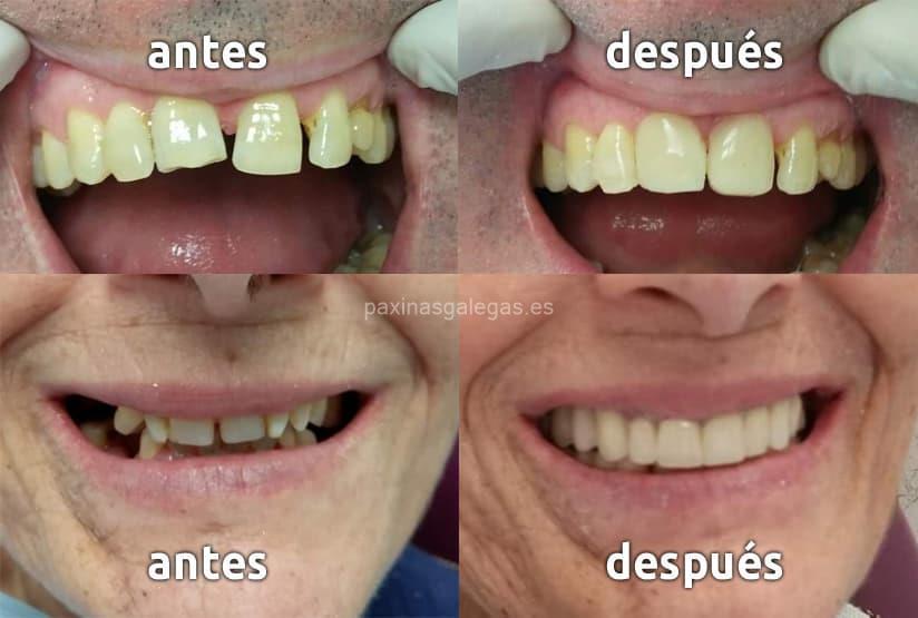Clínica Dental Castro Fernández imagen 8