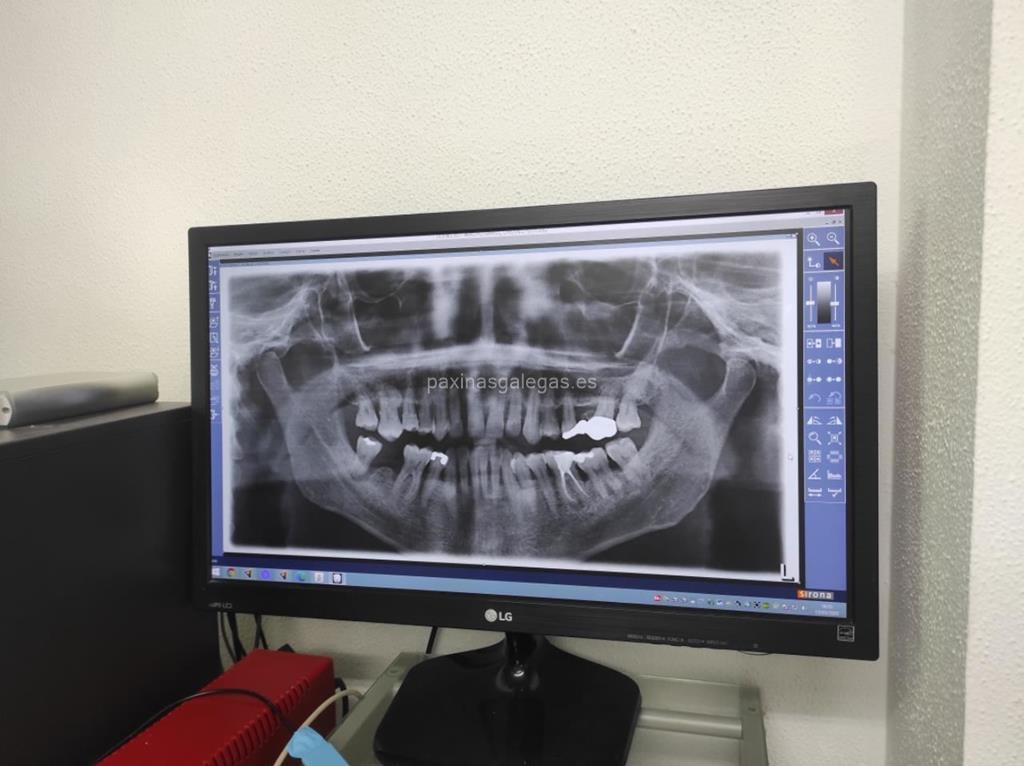 Clínica Dental Julio Vázquez imagen 6