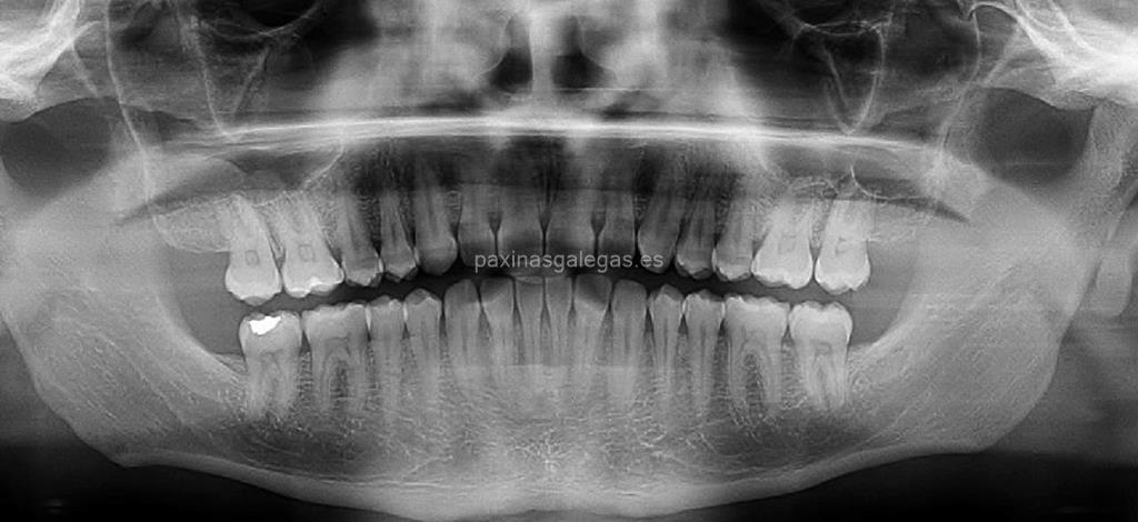 Clínica Dental Sobrino imagen 15
