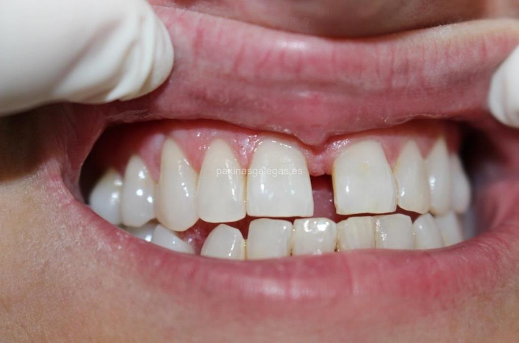 Clínica Dental Sobrino imagen 19