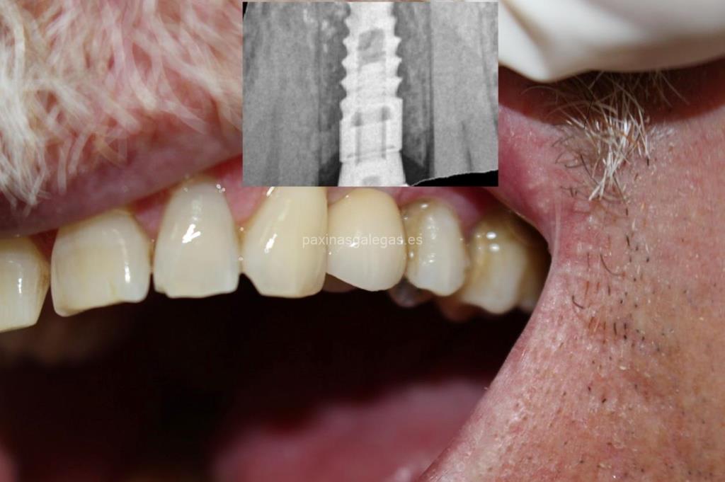 Clínica Dental Sobrino imagen 21