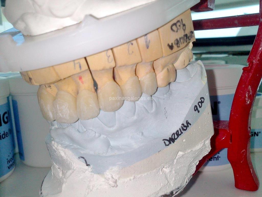 Laboratorio Dental Darriba imagen 8