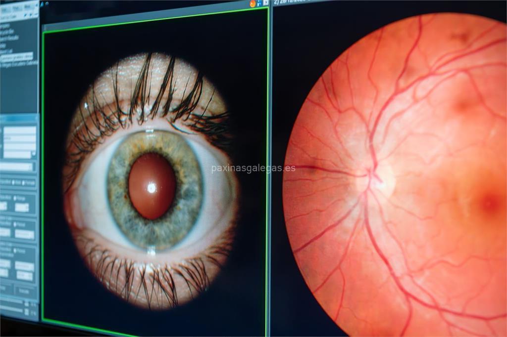Olladas Centro Óptico (Farmaoptics) imagen 9