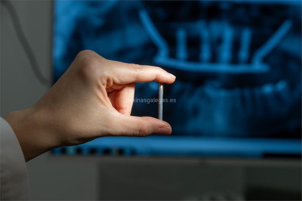 Titanium Clínica Dental & Estética imagen 12