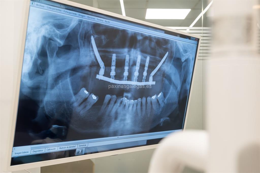 Titanium Clínica Dental & Estética imagen 13