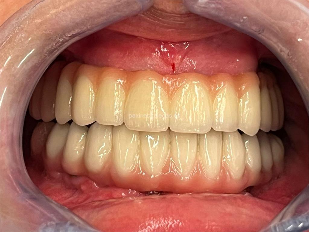 Titanium Clínica Dental & Estética imagen 17