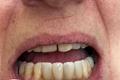 imagen 5 Titanium Clínica Dental & Estética