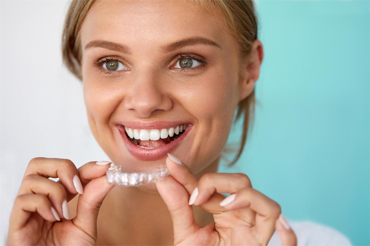 Los diferentes tipos de blanqueamientos dentales - Imagen 3