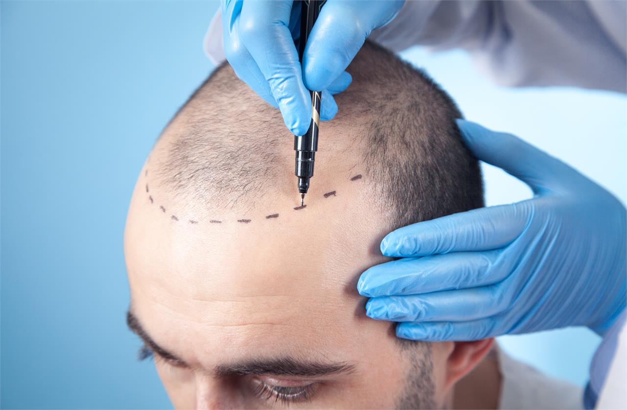 Los mejores tratamientos capilares para recuperar el cabello  - Imagen 1