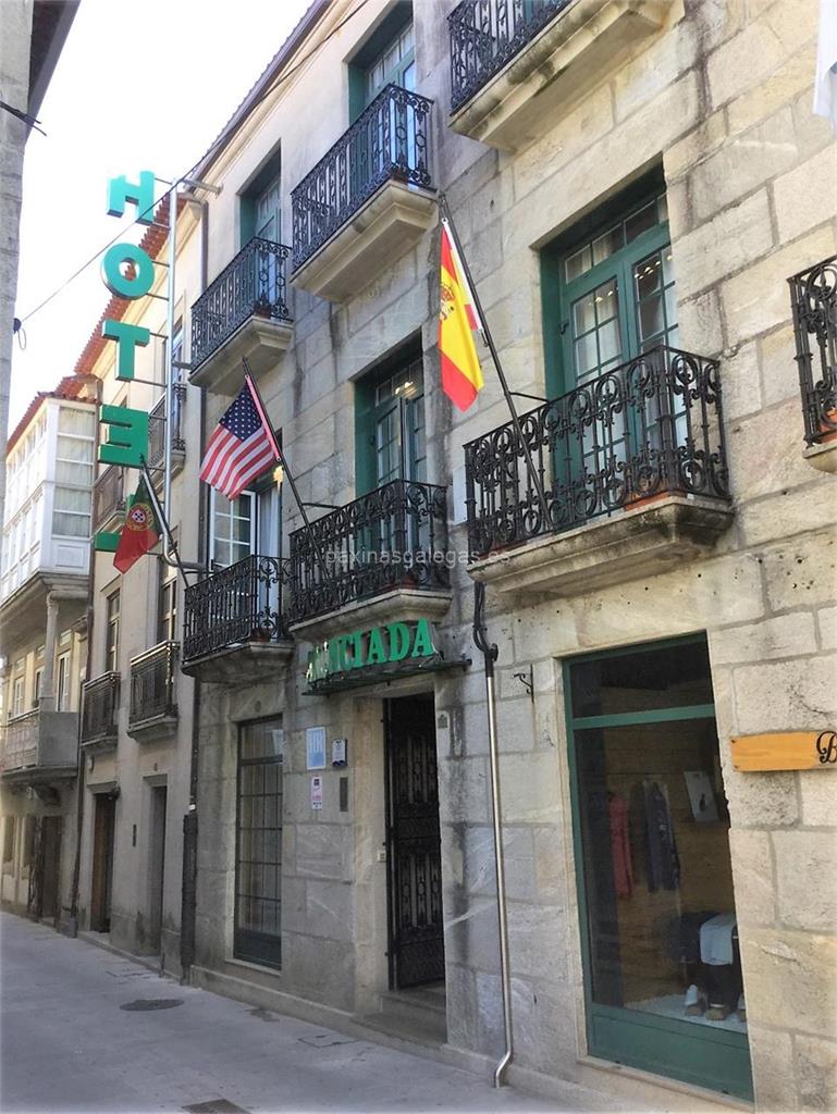 Hotel Anunciada — Baiona