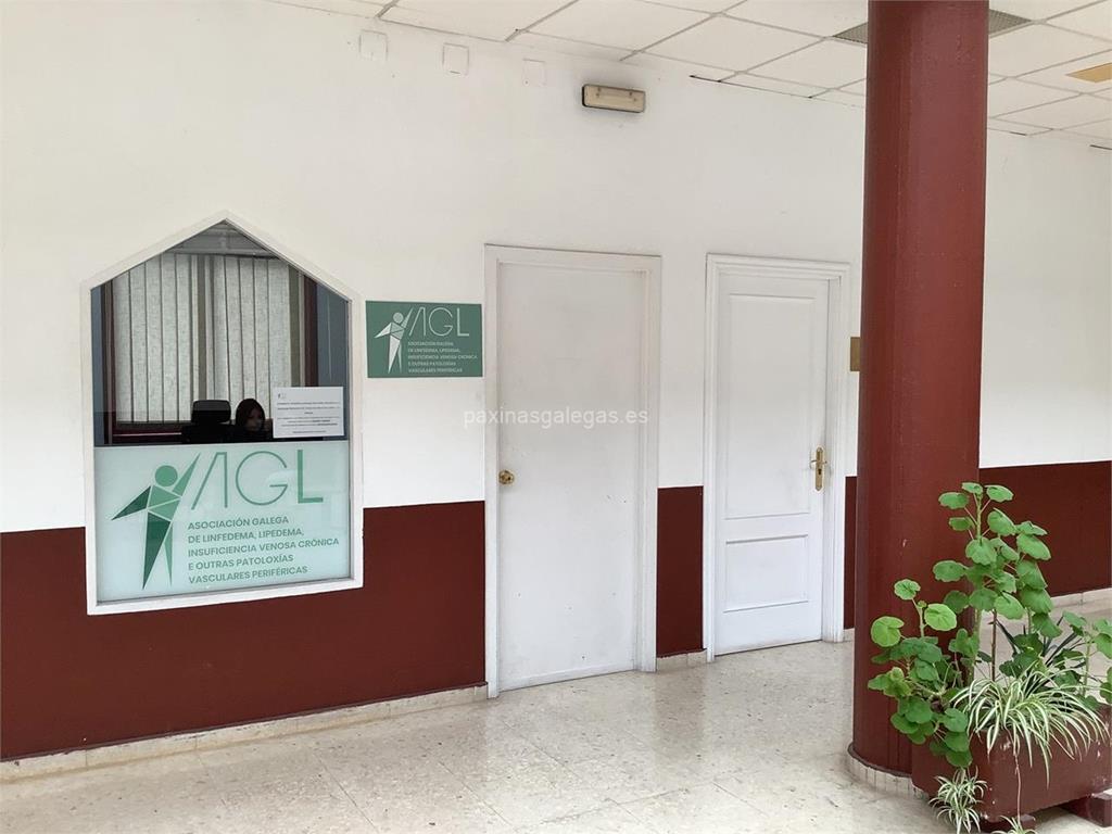 imagen principal Asociación Galega de Linfedema, Lipedema e Insuficiencia Venosa Crónica e Outras Patoloxías