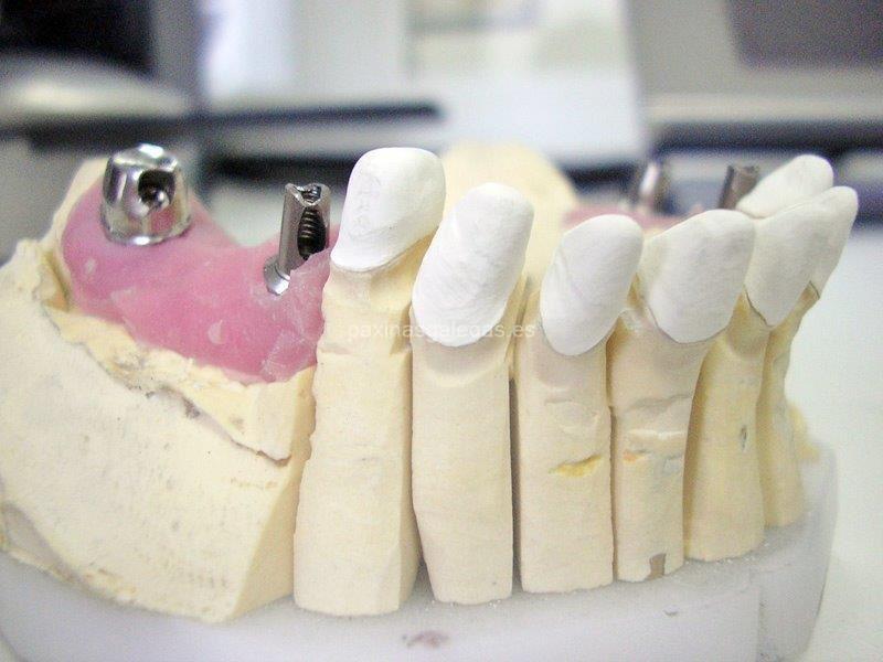 Atrident Laboratorio Dental imagen 11
