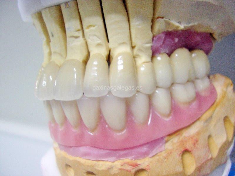 Atrident Laboratorio Dental imagen 12