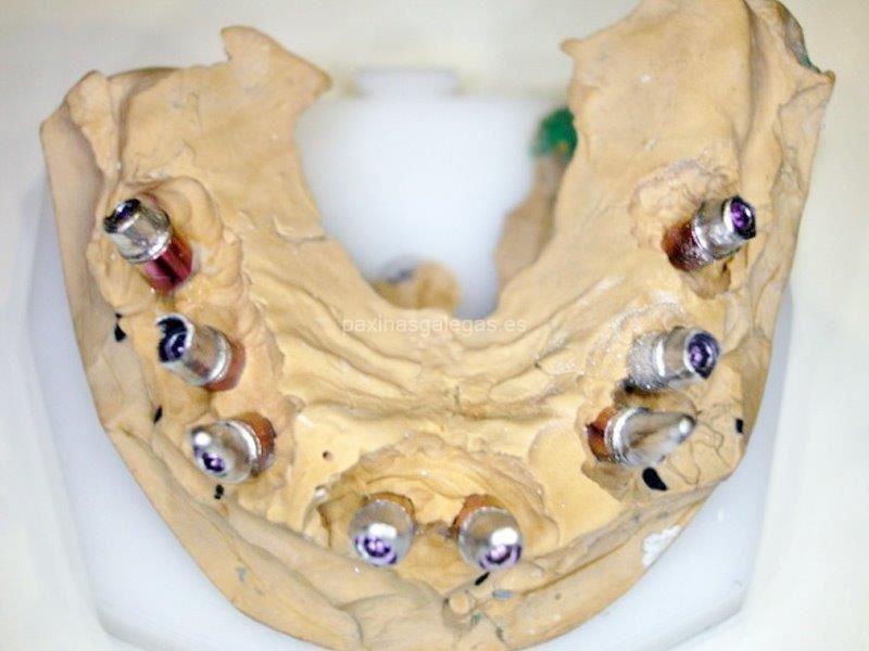 Atrident Laboratorio Dental imagen 14