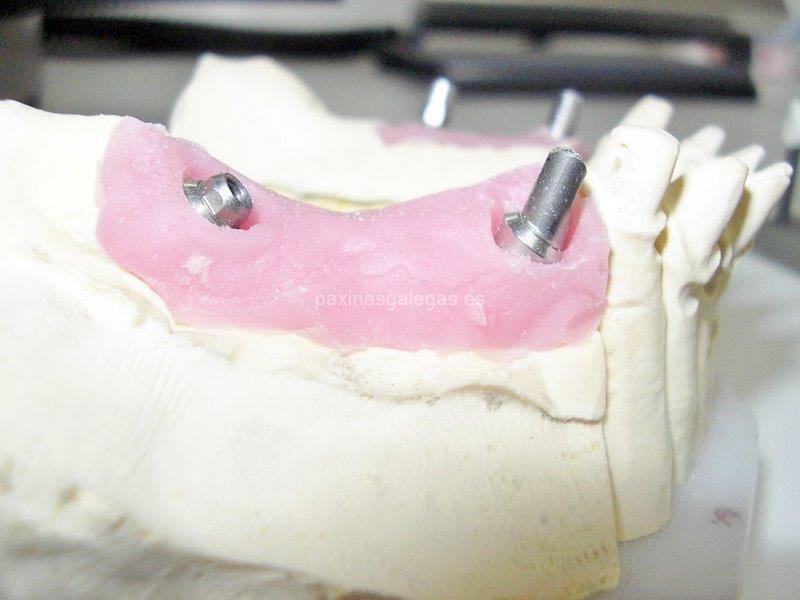 Atrident Laboratorio Dental imagen 10