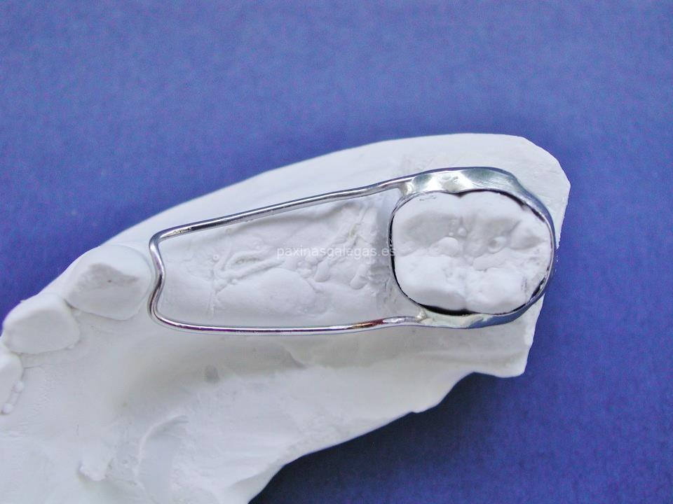 Biarc - Laboratorio de Ortodoncia imagen 16