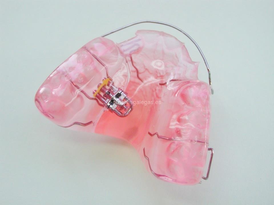 Biarc - Laboratorio de Ortodoncia imagen 18