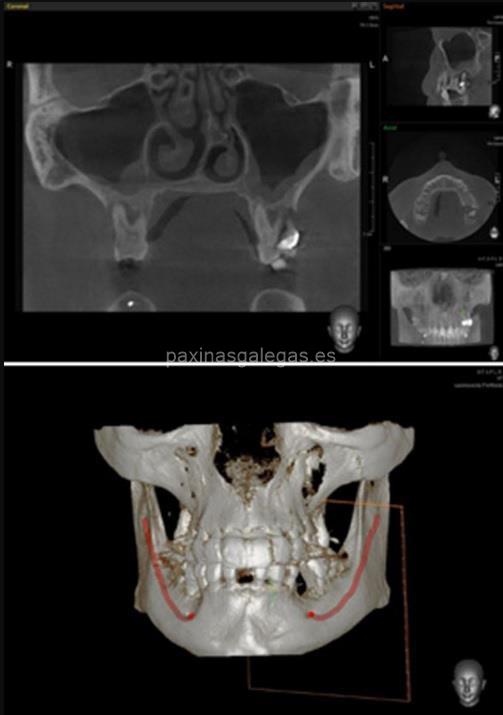 Clínica Abellás imagen 6