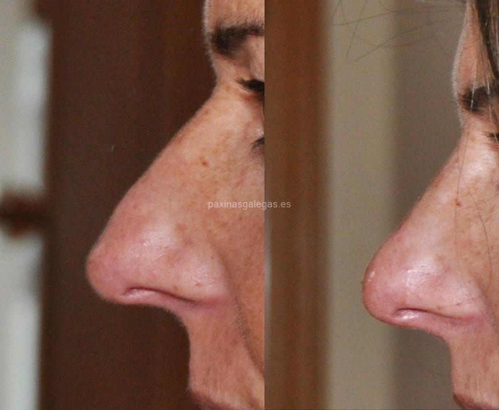 Clínica de Medicina Estética Dra. Mosquera imagen 8