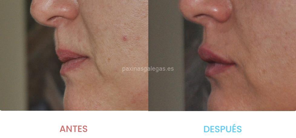 Clínica de Medicina Estética Dra. Mosquera imagen 10