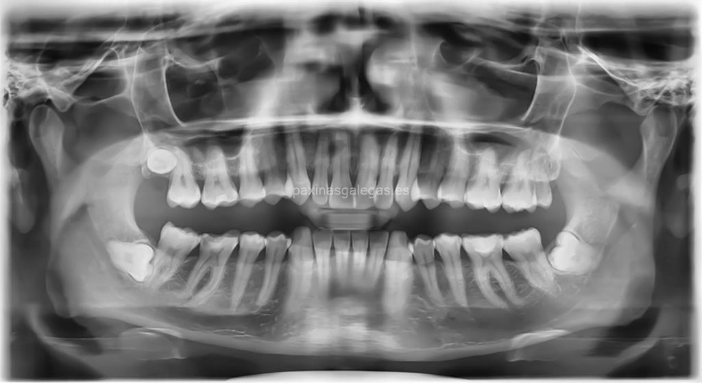 Clínica Dental Castelao imagen 14