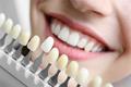imagen 5 Clínica Dental José Mª Barrera Aratano
