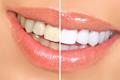 imagen 4 Clínica Dental Miguel Darriba