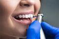 imagen 5 Clínica Dental Miguel Darriba