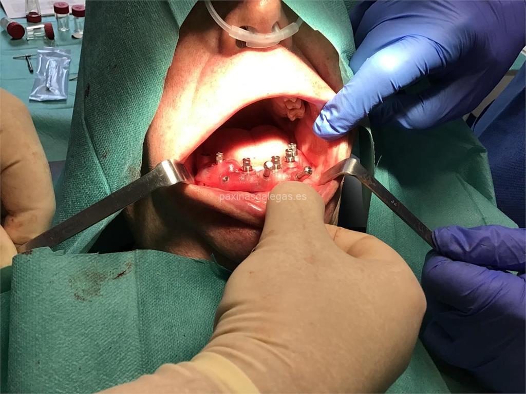 Clínica Dental Prego imagen 18