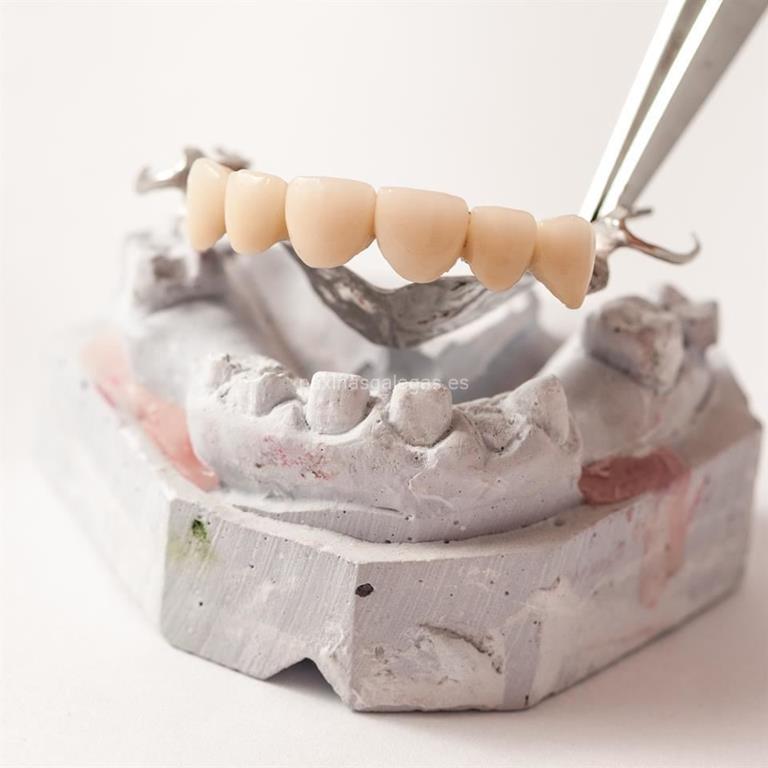 Clínica Dental Prego imagen 10