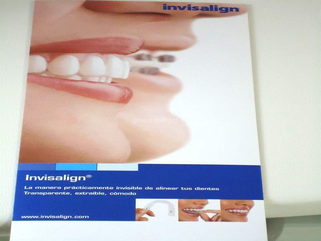 Clínica Dental San Amaro imagen 9
