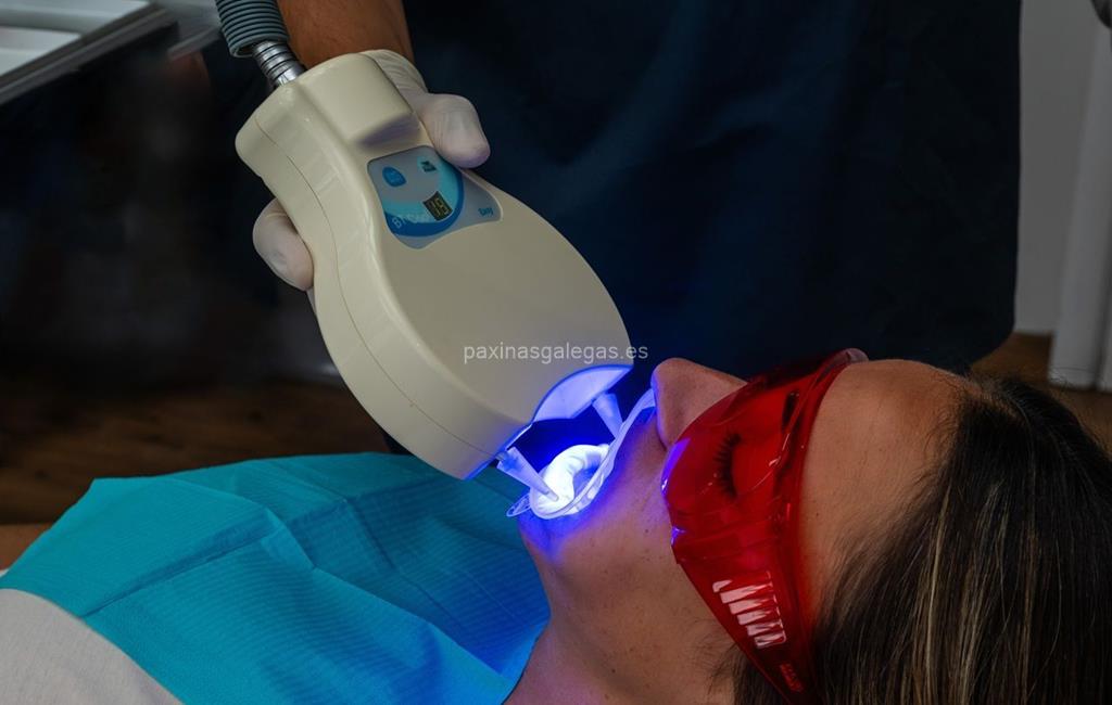 Clínica Dental San Amaro imagen 10
