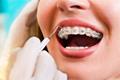 imagen 4 Clínica Dental Senlleira - Dra. Olga Loroño