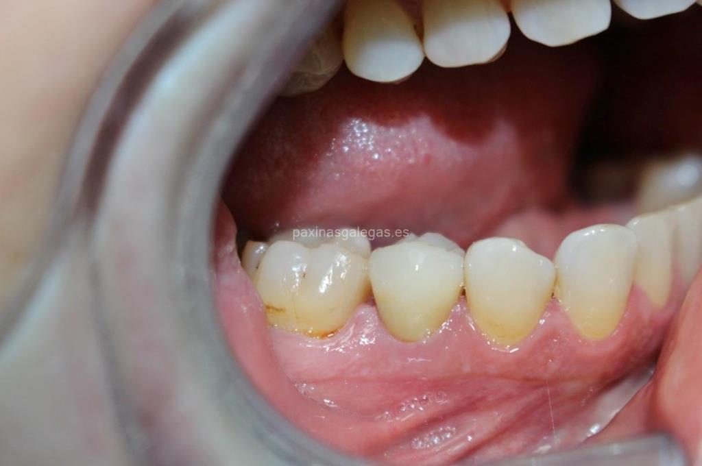 Clínica Dental Sobrino imagen 16