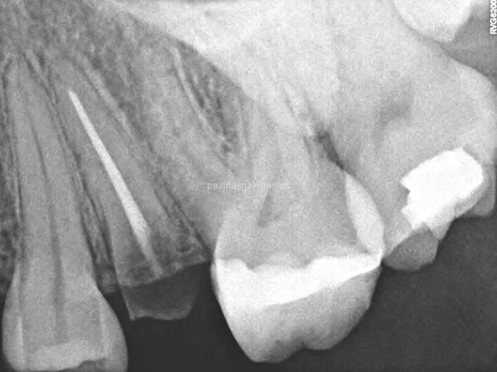 Clínica Dental Sobrino imagen 17