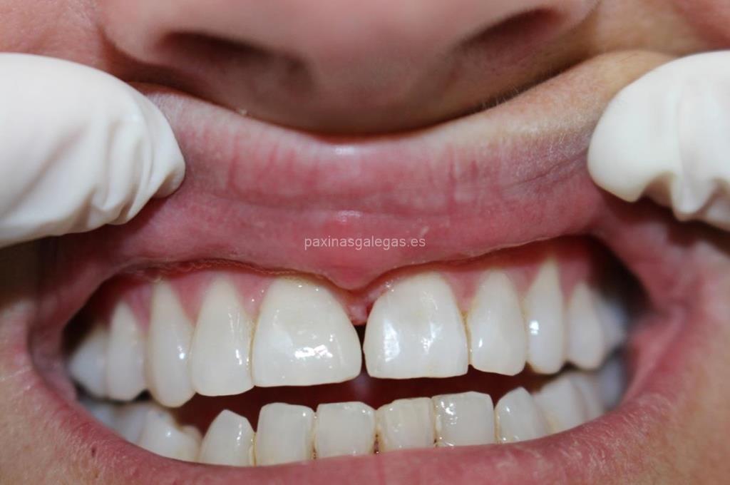 Clínica Dental Sobrino imagen 20