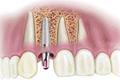 imagen 2 Clínica Dental Vila Real