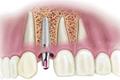 imagen 2 Clínica Dental Vila Real