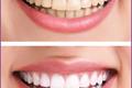 imagen 3 Clínica Dental Vila Real