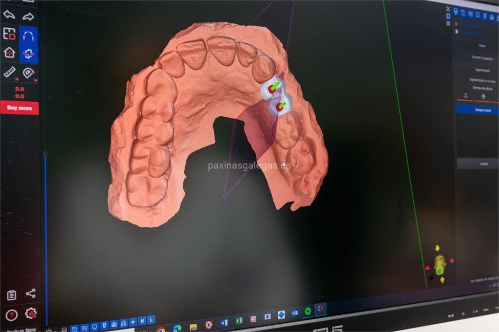 Clínica Implanteoral Milladoiro imagen 13