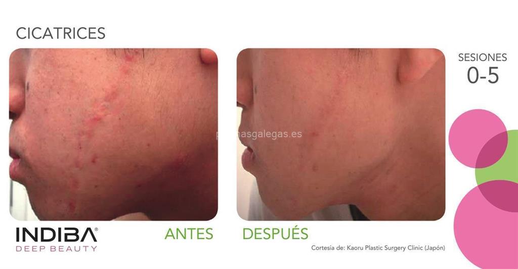 Eva Figueroa López (Centro Indiba) imagen 9