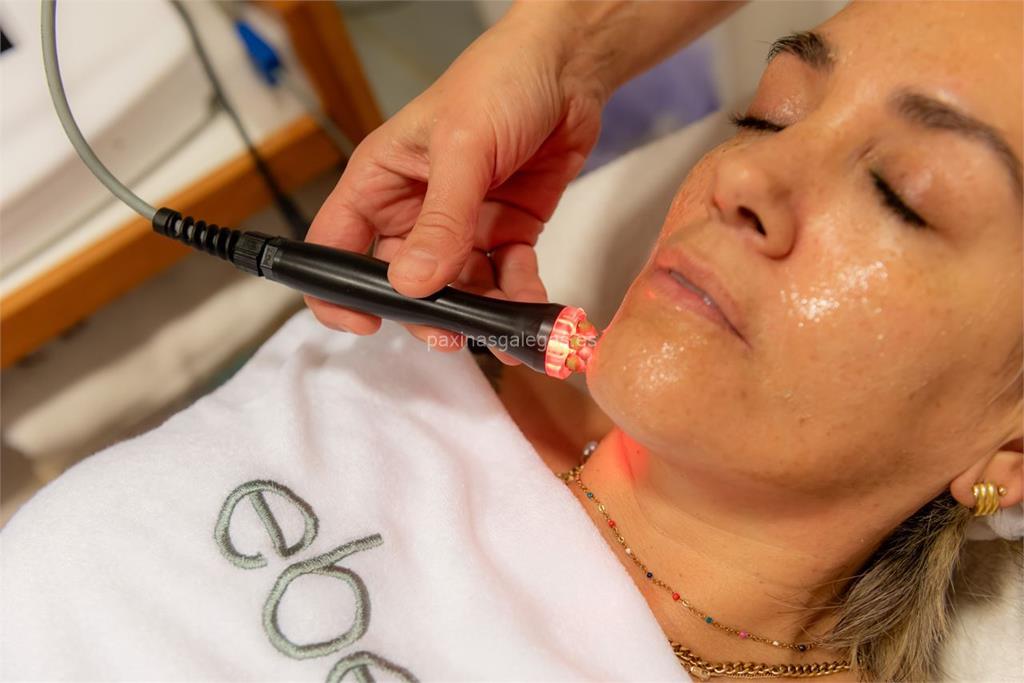 Kenshoo (La Phyto) imagen 13