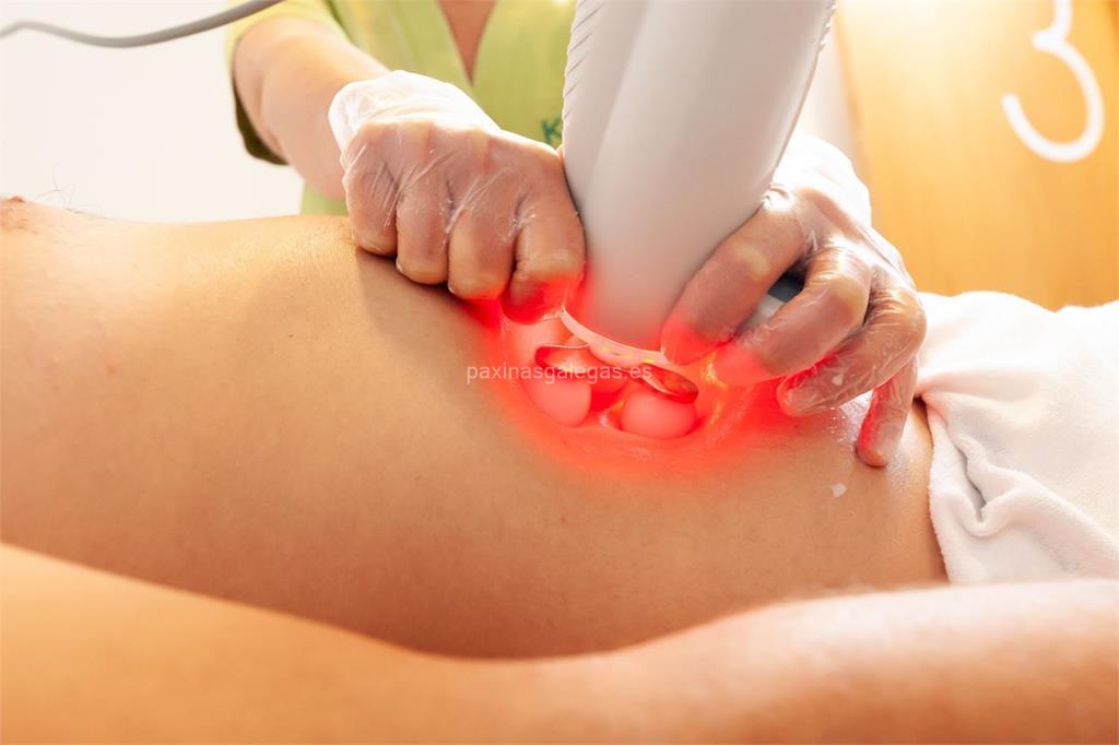 Kenshoo (La Phyto) imagen 10