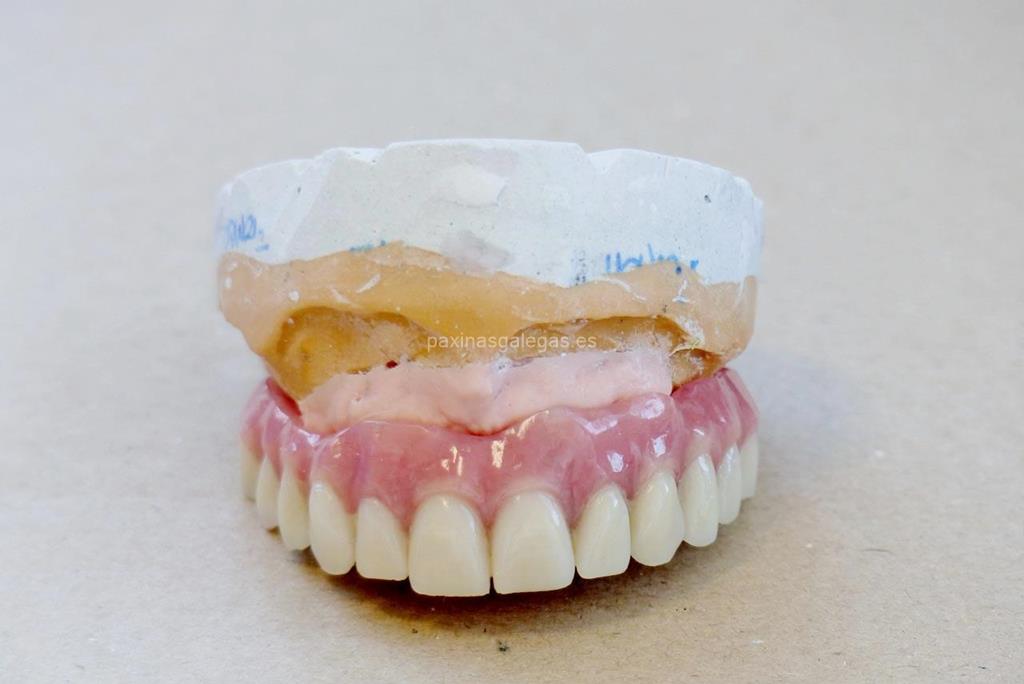 Laboratorio Dental Darriba imagen 12
