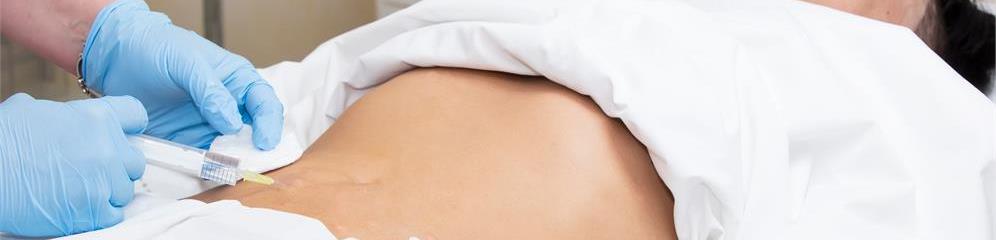 Mesoterapia en provincia Lugo