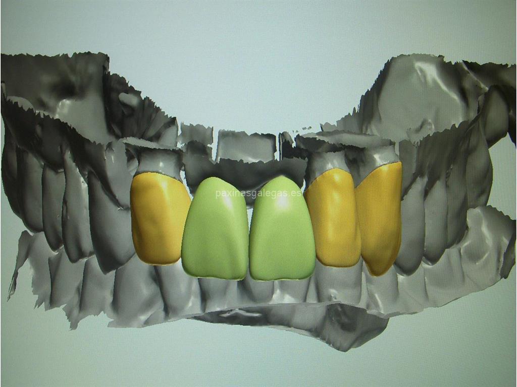 Nordental imagen 6