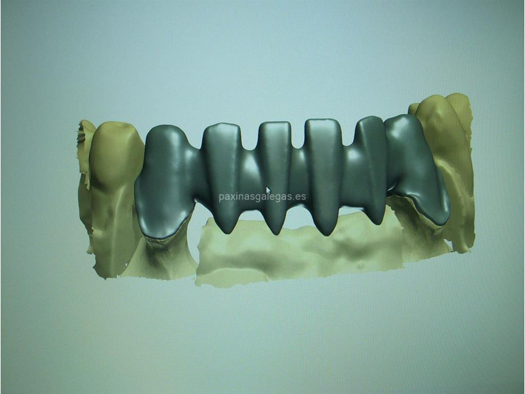 Nordental imagen 7