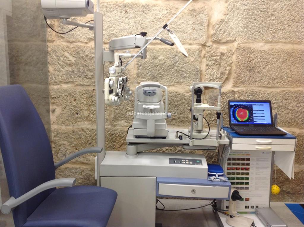Opticalia imagen 7